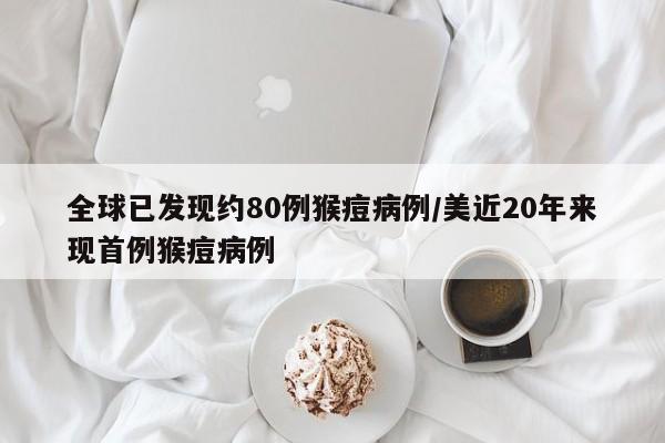 全球已发现约80例猴痘病例/美近20年来现首例猴痘病例